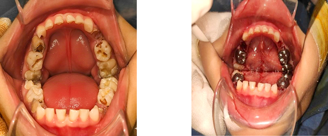 Nhấn vào ảnh để phóng to