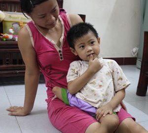 Nụ cười trong trẻo của “cô bé 3 chân”