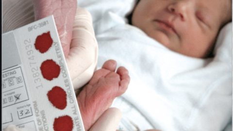 Sàng lọc rối loạn chuyển hóa bẩm sinh
