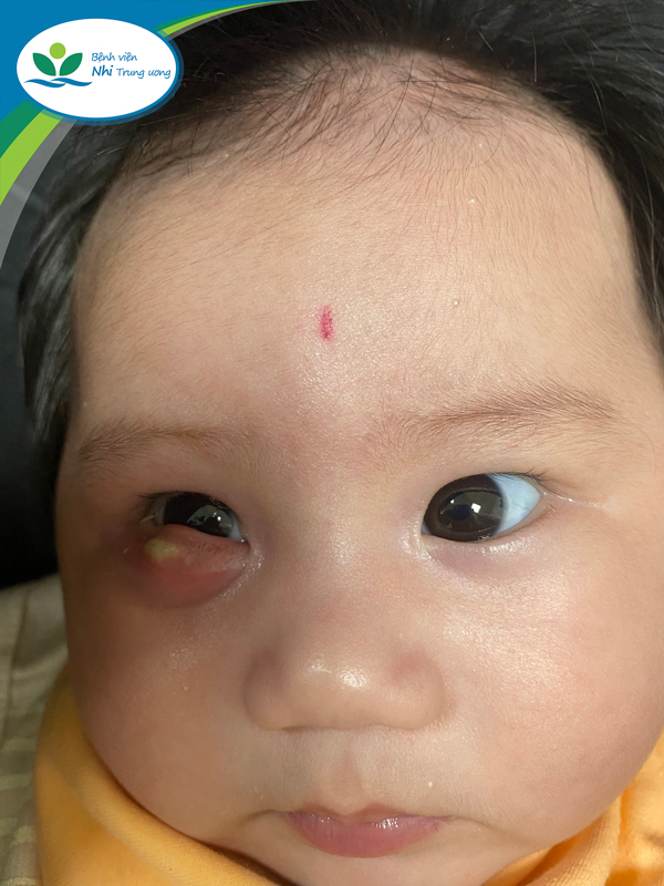 Nhấn vào ảnh để phóng to