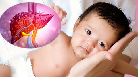 Thông tin về bệnh viêm gan cấp chưa rõ nguyên nhân ở trẻ em