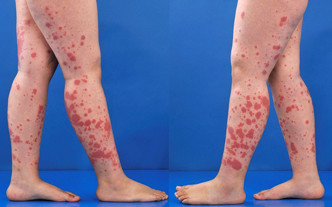 Nhấn vào ảnh để phóng to