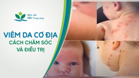 [VIDEO] Viêm da cơ địa: Cách chăm sóc và điều trị