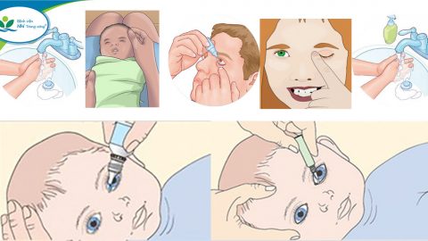 Hướng dẫn sử dụng các thuốc nhỏ mắt