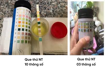 Hướng dẫn bệnh nhân hội chứng thận hư (HCTH) theo dõi protein niệu bằng que thử nước tiểu tại nhà