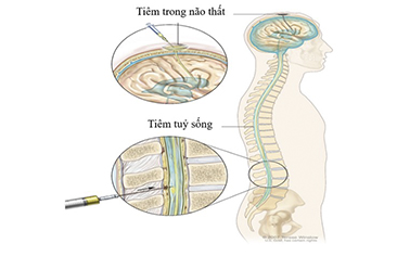 [QUÝ I-2024] CÁC ĐƯỜNG ĐƯA THUỐC VÀO DỊCH NÃO TỦY