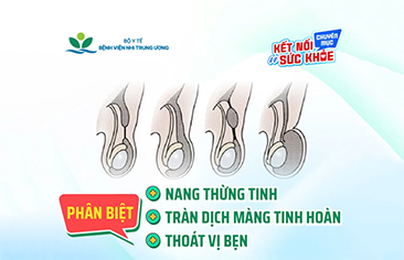 Phân biệt thoát vị bẹn, nang thừng tinh, tràn dịch màng tinh hoàn