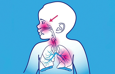 Men vi sinh và thời gian sốt trên trẻ nhiễm khuẩn đường hô hấp trên