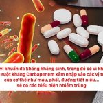 [VIDEO] Nguy cơ, nguyên nhân, chiến lực quản lý và sử dụng kháng sinh đúng đắn nhằm phòng ngừa vi khuẩn đa khuẩn đa kháng thuốc