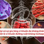 [VIDEO] Tại sao có sự gia tăng của vi khuẩn đa kháng kháng sinh, đặc biệt là vi khuẩn đường ruột kháng Carbapenem và làm thế nào để kiểm soát và ngăn chặn sự lây lan của vi khuẩn đa kháng kháng sinh