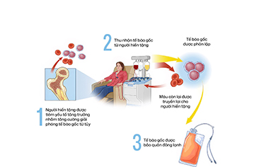 Chăm sóc dự phòng nhiễm trùng ở người bệnh ghép tế bào gốc