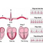 Điện tâm đồ cơ bản ở trẻ em trong thực hành điều dưỡng