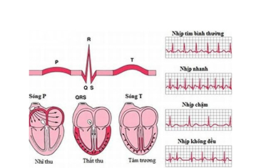 Điện tâm đồ cơ bản ở trẻ em trong thực hành điều dưỡng