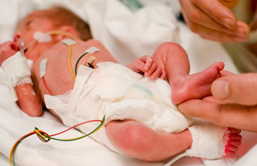 Hiệu quả của chiến lược điều trị sớm dựa trên phân tầng nguy cơ trong điều trị còn ống động mạch ở trẻ sinh non: Kết quả từ một nghiên cứu quan sát