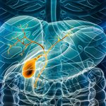 Hiệu quả lâm sàng việc phối hợp phenobarbital với ursodeoxycholic acid trong điều trị trẻ sơ sinh mắc ứ mật