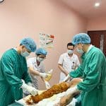 Bé trai bỏng nặng do tự làm thí nghiệm với cồn tại nhà: Cảnh báo từ tai nạn sinh hoạt thường gặp