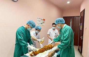 Bé trai bỏng nặng do tự làm thí nghiệm với cồn tại nhà: Cảnh báo từ tai nạn sinh hoạt thường gặp