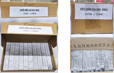 Lưu trữ mẫu Giải phẫu bệnh: Sáng kiến cải tiến đột phá tại Bệnh viện Nhi Trung ương