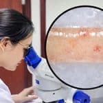 Quy trình xét nghiệm Giải phẫu bệnh sinh thiết thận – “Chìa khóa” giúp chẩn đoán chính xác bệnh thận