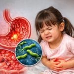 Xét nghiệm Giải phẫu bệnh đạt chứng chỉ công nhận ISO 15189:2022 – Nền tảng chẩn đoán chính xác viêm dạ dày ở trẻ em