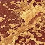 Sự hình thành biofilm của vi khuẩn và các kháng sinh chống lại biofilm