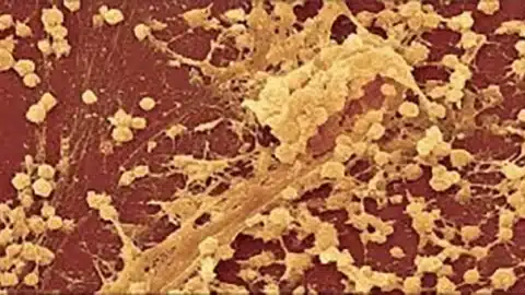 Sự hình thành biofilm của vi khuẩn và các kháng sinh chống lại biofilm