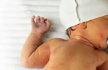 Tác dụng của phenobarbital trong tăng bilirubin máu ở trẻ sơ sinh: Tổng quan hệ thống và phân tích meta thử nghiệm ngẫu nhiên có đối chứng