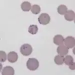 Tổng quan về điều trị Mycoplasma pneumoniae kháng macrolid