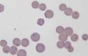 Tổng quan về điều trị Mycoplasma pneumoniae kháng macrolid