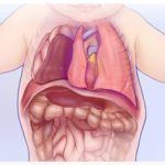 [Thông tin cần biết] Cha mẹ có con bị thoát vị hoành bẩm sinh