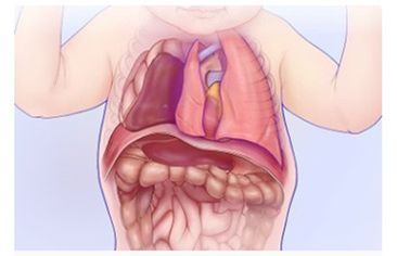 [Thông tin cần biết] Cha mẹ có con bị thoát vị hoành bẩm sinh