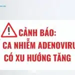 Adenovirus có xu hướng gia tăng, cha mẹ cần cảnh giác với các nguy cơ lây nhiễm – Những khuyến cáo từ chuyên gia của Bệnh viện Nhi Trung ương