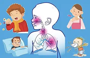 Hiệu quả của sản phẩm vi sinh chứa chủng lợi khuẩn L. plantarum và P. acidilactici trong điều trị nhiễm trùng đường hô hấp trên ở trẻ em từ 6 tháng đến 5 tuổi